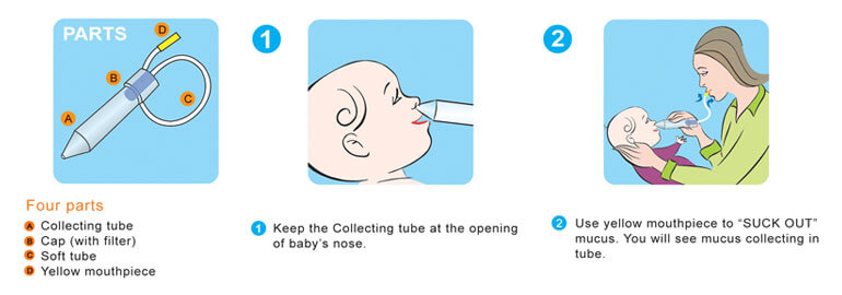 Clearing baby's congested nose