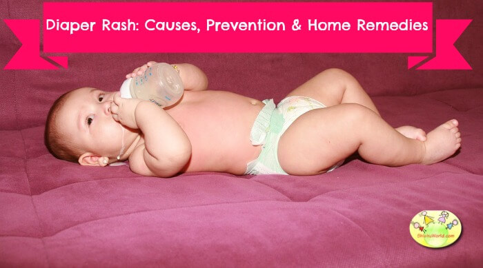 Causes, prevention & home remedy for diaper rash